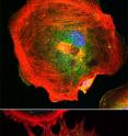 Top: Migrating fibroblasts reach out with veil-like protrusions known as lamellipodia. Bottom: Fibroblasts without a functional Arp2/3 complex are unable to form lamellipodia. Instead they form spiky edges known as filopodia. Actin is shown in red, ARP2 is in green, and DNA in blue.