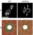 MOD+ yeast contain Mod5 aggregates (upper) and acquire resistance to an antifungal agent, fluconazole (lower).