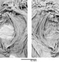 This is a skull of the primitive flatfish <i>Heteronectes,</i> with views of the left- and right-hand sides. The left-hand side shows an eye that has migrated toward the top of the skull, but not reached the other side, in this adult specimen. This is a skull of the primitive flatfish <i>Heteronectes,</i> with views of the left- and right-hand sides. The left-hand side shows an eye that has migrated toward the top of the skull, but not reached the other side, in this adult specimen.