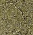 A photomicrograph of superficial keratinocytes or skin cells.