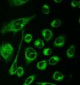 This image shows live cells incubated with the polymer nanoparticles.  The green color is the fluorescence coming from the molecules trapped within the nanoparticles.