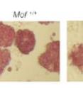 Mouse stem cells with two normally functioning copies of the Mof gene (left) have intact "stem-ness" -- but that ability to self-renew is lost in cells in which one or both copies of Mof don't work correctly (middle and right). Mouse stem cells with two normally functioning copies of the Mof gene (left) have intact "stem-ness" -- but that ability to self-renew is lost in cells in which one or both copies of Mof don't work correctly (middle and right).