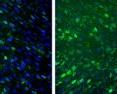 A population of fat-derived stem cells expresses the bone-specific COL1A1 gene. Green fluorescence from a “molecular beacon” shows increasing expression from day nine, left, through day 11 and day 14. By day 16, right, expression begins to wane.