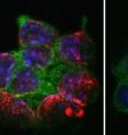 Mouse embryonic stem cells (blue, green) lose DNA methylation (red) in the absence of UHRF1.