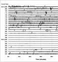 24 hours of data from a seismic station in Mudanjiang, China, on the date of one purported 2010 North Korean nuclear test. Background levels are higher during working hours than at night, suggesting human causes such as traffic, electric motors and passing trains -- but there is no indication of a nuclear explosion, say the authors of a new paper. Each line represents one hour, sampled 40 times per second.