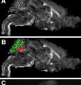 A. This is a high-field MRI scan of the entire brain of a mouse that received the transplant of human stem cells (HuCNS-SCs; spinal cord is at lower left and the front of the brain is far right)
B. The red color identifies regions in white matter where the MRI signal predicted that stem cells made new myelin. Green areas predicted no myelin.
C. An analysis for human myelin was done in the region of the brain seen on the MRI in red and green in panel B.  Regions in white confirmed that myelin was present where predicted by the MRI signal in panel B.