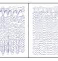 Those whose brain waves oscillated most powerfully in the alpha spectrum (about 10 times per second) when measured at the front of the head (left EEG readout) tended to learn at a faster rate than those whose brain waves oscillated with less power (readout on the right), the researchers found.