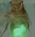 This shows an epithelial tumor (in green) implanted in a fly host.