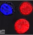 Identical cells stained red and blue were the target of research at Rice University to show the effect of plasmonic nanobubbles. The bubbles form around heated gold nanoparticles that target particular cells, like cancer cells. When the particles are hollow, bubbles form that are large enough to kill the cell when they burst. When the particles are solid, the bubbles are smaller and can punch a temporary hole in a cell wall, allowing drugs or other material to flow in. Both effects can be achieved simultaneously with a single laser pulse.