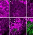 This series of harmonic generation microscopy images shows the skin cells of a 24-year-old subject at increasing depths, ranging from the outermost layer of skin (a) to approximately 300 millionths of a meter deep (f). The magenta areas, generated from third harmonics, show skin cells and their nuclei. The green areas, generated from second harmonics, show fibers made of the protein collagen.