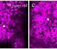 This shows images of basal keratinocytes, the most common cells in the outermost layer of skin. The images were taken of the forearms of a 24-year-old (a), a 47-year-old (b), a 59-year-old (c) and a 69-year-old (d). Compared to the skin cells of the youngest volunteers, the skin cells in older subjects were larger, more irregular in shape, and showed spaces between cells, as indicated by the white arrows in images b-d.