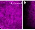 This shows images of granular skin cells, a type of cell found near the top of the outermost layer of skin, for a 24-year-old (a), a 47-year-old (b), a 59-year-old (c) and a 69-year-old (d). In contrast to the irregularities that developed in the basal cells of older subjects, the images of granular cells revealed no significant correlation between age and size or shape of the cells.