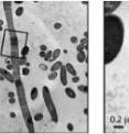 The depletion of ATP in cells of the bacterium <I>Escherichia coli</I> causes them to transition to a filamentous state and form dense lipid structures known as endoliposomes. The structures can be clearly observed in these transmission electron micrographs of increasing magnification.