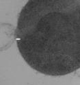 This is a transmission electron microscopy image of a <i>Streptococcus pyogenes</i> cell experiencing lysis after exposure to the highly active enzyme PlyC.