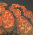 Mitochondria (bright areas) are visible in these stained fruit fly ovary cells.