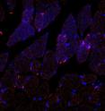 Collagen IV-targeted polymeric nanoparticles (shown in pink) are home to injured tissue, post-injection, in the blood.