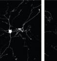 More branched growth in neurons (right) occurred when experimenters added more of the axonally targeted mRNA for the repair protein beta-actin.