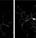 More elongated growth in neurons (right) occurred when experimenters added more of the axonally targeted mRNA for the repair protein GAP-43.