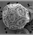 This shows cells of the coccolithophore species <i>Emiliania huxleyi</i> strain NZEH under present-day, left, and future high, right, carbon dioxide conditions.