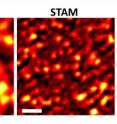 A new type of super-resolution optical microscopy takes a high-resolution image (at right) of graphite "nanoplatelets" about 100 nanometers wide. The imaging system, called saturated transient absorption microscopy, or STAM, uses a trio of laser beams and represents a practical tool for biomedical and nanotechnology research.