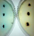 Dyes are added to colonies of superoxide-producing bacteria growing on laboratory plates.