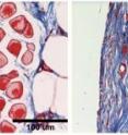 These images show differences in collagen build-up in two tissue samples. Collagen is labeled in blue. The left image shows a thick collagen wall forming in the presence of a material that's widely used for implantable devices. In contrast, collagen in the right image is more evenly dispersed in the tissue after the UW-engineered hydrogel has been implanted.
