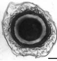 This is a spore of <i>Clostridium botulinum</i>.