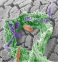 Patients with type 2 diabetes have an altered gut microbiota. These are the findings of researchers at the Sahlgrenska Academy, University of Gothenburg, Sweden and Chalmers University of Technology, Sweden. Patients with type 2 diabetes have an altered gut microbiota. These are the findings of researchers at the Sahlgrenska Academy, University of Gothenburg, Sweden and Chalmers University of Technology, Sweden.