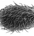 The protist <i>Tetrahymena</i> hunts <i>E. coli</i> in this photo illustration, which features a microscope image of <i>Tetrahymena</i> (left). A new study finds that Shiga toxin may help <i>E. coli</i> survive in the face of such predation. The protist <i>Tetrahymena</i> hunts <i>E. coli</i> in this photo illustration, which features a microscope image of <i>Tetrahymena</i> (left). A new study finds that Shiga toxin may help <i>E. coli</i> survive in the face of such predation.