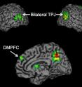 Psychologists report for the first time that the temporoparietal junction (TPJ) and dorsomedial prefrontal cortex (DMPFC) brain regions are associated with the successful spread of ideas, often called "buzz."