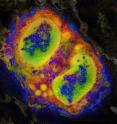 Visualizing eosinophilic esophagitis: this is a computer-enhanced color image of an immune cell infiltrating the inflamed esophagus of a mouse.