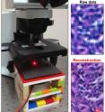 Changhuei Yang's lab at Caltech has developed a new microscope setup (left) that converts a relatively inexpensive conventional microscope into a billion-pixel  imaging system that significantly outperforms the best available standard microscope. A raw image taken with a 2X objective lens is shown (top right) along with the reconstructed image produced by the new microscope setup (bottom right).