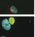 The top image shows uninfected, normal human cells with cell nuclei in blue and the cellular protein processing apparatus in red. In the infected cells (bottom image), the virus has produced proteins (green) that take over and reorganize the cellular processing apparatus into a virus factory.