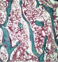 This image shows a bone biopsy.