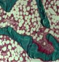 This image shows a bone biopsy.