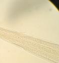 This is the front of the <i>Haemonchus contortus</i> (Barber Pole) worm.
