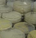 These are Petri dishes containing some of the many bacterial symbionts carried by social amoeba farmers.