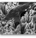 This is a bone cell anchoring itself to a surface of titanium dioxide nanotubes. Because osteoblasts readily adhere to this novel surface, dental implants coated with TiO2 nanotubes could significantly improve healing following dental implant surgery.