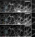 The resolution difference between standard microscopy and SIM technology can be clearly seen.