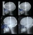 Male noses grow disproportionately larger than female noses beginning at puberty, a University of Iowa study has found. The reason: males need to breathe in more oxygen to feed muscle mass than females.