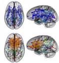 Brain networks show increased connectivity from front to back and within one hemisphere in males (upper) and left to right in females (lower).