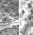 The left electron microscope image shows "exocytosis." Parts of two nerve cells from a mouse brain are shown, top and bottom, with the gap or synapse between them appearing as horizontal lines. The top nerve cell is filled with tiny round bubbles known as vesicles.  One of those vesicles, which appears like an upside-down "U" in the middle of the image, is fusing to the inside of the nerve cell to send its load of neurotransmitters to the nerve cell below. The right image shows "endocytosis," the recycling of a nerve cell vesicle. The recycled vesicle that is taking shape appears as the large bubble toward the right center of the image. University of Utah and German biologists made these photos using a new method to "flash and freeze" nerve cells in action.