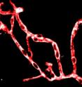 Studies in mice showed how brain blood vessel cells called pericytes (white) may contribute to the problems associated with Alzheimer's disease.