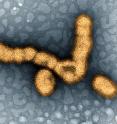 This image shows H1N1 influenza virus particles.