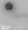 The newly-isolated Tsamsa virus is a bacteriophage that infects and kills the anthrax bacterium and close relatives that cause food poisoning. It is one of the largest bacteriophages ever discovered.