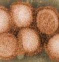 This is the influenza virus under the electron microscope.