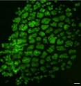 As a new bioinspired, sponge-like gel shrinks, it squeezes cells (green) inside it, triggering them to shrink, round up, become denser, and begin to deposit the minerals that harden teeth.