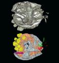 This is the ostracod <I>Luprisca incuba</I> from 450 million-year-old rocks of New York State, USA, with eggs protruding from the rear of the shell and limbs at the front of the animal, as photographed and captured by X-ray CT studies (eggs and possible hatched individuals in yellow).