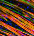 Long, colorful strands of engineered muscle fiber have been stained to observe growth after implantation into a mouse.