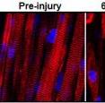 This series of images shows the destruction and subsequent recovery of engineered muscle fibers that had been exposed to a toxin found in snake venom. This marks the first time engineered muscle has been shown to repair itself after implantation into a living animal.